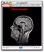 MRI Stack with stack counter